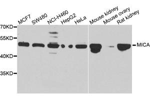 Western blot analysis of extracts of various cell lines, using MICA antibody. (MICA antibody)