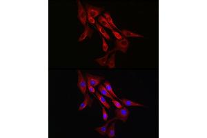 Immunofluorescence analysis of NIH/3T3 cells using α-Tubulin Rabbit mAb (ABIN7271036) at dilution of 1:100 (40x lens). (TUBA4A antibody)
