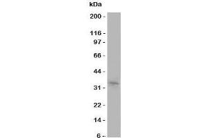Western blot testing of Aquaporin 10 antibody and COLO320 cell lysate