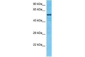 Host:  Rabbit  Target Name:  ZNF776  Sample Type:  MCF7 Whole Cell lysates  Antibody Dilution:  1.