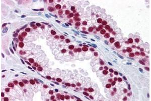 Human Prostate: Formalin-Fixed, Paraffin-Embedded (FFPE) (SAFB antibody  (AA 111-201))
