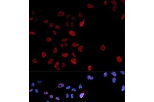Immunofluorescence analysis of U2OS cells using Phospho-MYC(S62) Polyclonal Antibody (c-MYC antibody  (pSer62))