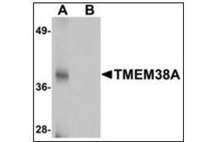 Western blot analysis of TMEM38A in rat skeletal muscle tissue lysate with TMEM38A antibody at 1 µg/ml in (A) the absence and (B) the presence of blocking peptide.
