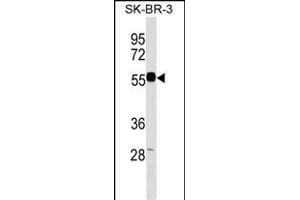 EEPD1 Antibody (C-term) (ABIN1537333 and ABIN2849670) western blot analysis in SK-BR-3 cell line lysates (35 μg/lane). (EEPD1 antibody  (C-Term))
