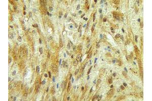 Image no. 1 for anti-Colony Stimulating Factor 3 (Granulocyte) (CSF3) antibody (ABIN465577) (G-CSF antibody)
