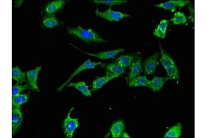 Immunofluorescent analysis of Hela cells using ABIN7175921 at dilution of 1:100 and Alexa Fluor 488-congugated AffiniPure Goat Anti-Rabbit IgG(H+L) (XAF1 antibody  (AA 172-259))