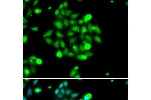 Immunofluorescence analysis of U2OS cells using UBE2G1 Polyclonal Antibody (UBE2G1 antibody)