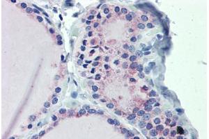 Thyroid, Human: Formalin-Fixed, Paraffin-Embedded (FFPE) (GNAS antibody  (AA 36-85))