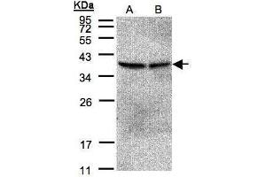WB Image Sample(30 μg of whole cell lysate) A:293T B:A431, 12% SDS PAGE antibody diluted at 1:500