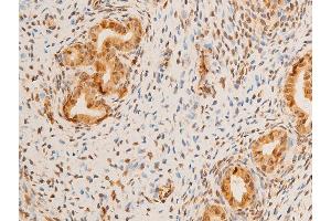 ABIN6267273 at 1/100 staining rat uterine tissue sections by IHC-P.