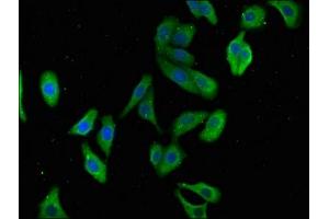 Immunofluorescence (IF) image for anti-Tumor Necrosis Factor, alpha-Induced Protein 8-Like 2 (TNFAIP8L2) (AA 1-184) antibody (ABIN7173782)