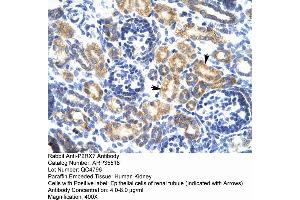 Human kidney (P2RX7 antibody  (N-Term))
