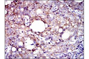 Immunohistochemistry (IHC) image for anti-Integrin beta 1 (ITGB1) antibody (ABIN1844058) (ITGB1 antibody)