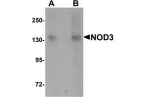 Western blot analysis of NOD3 in 3T3 cell lysate with NOD3 antibody at (A) 1 and (B) 2 μg/ml. (NLRC3 antibody  (Center))