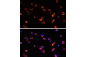 Immunofluorescence analysis of L929 cells using B antibody (ABIN6130859, ABIN6137109, ABIN6137110 and ABIN6220869) at dilution of 1:100. (ARL13B antibody  (AA 1-240))