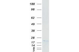 MRPL18 Protein (Myc-DYKDDDDK Tag)