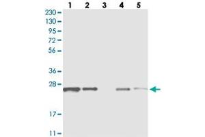 Western blot analysis of Lane 1: RT-4, Lane 2: U-251 MG, Lane 3: Human Plasma, Lane 4: Liver, Lane 5: Tonsil with C1orf52 polyclonal antibody  at 1:250-1:500 dilution. (C1ORF52 antibody)