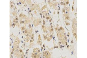 Immunohistochemistry of paraffin-embedded Human stomach using PSMB5 Polyclonal Antibody at dilution of 1:200 (40x lens).