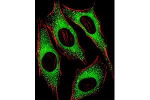 Fluorescent image of Hela cells stained with FGFR2 Antibody (N-term). (FGFR2 antibody  (N-Term))