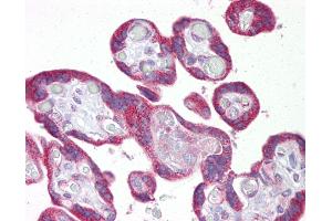 Anti-KRT23 / Cytokeratin 23 antibody IHC of human placenta. (KRT23 antibody  (C-Term))