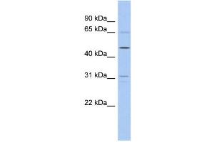 WB Suggested Anti-ZNF641 Antibody Titration:  0. (ZNF641 antibody  (Middle Region))