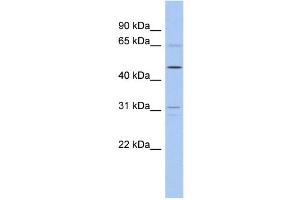 WB Suggested Anti-ZNF641 Antibody Titration:  0.