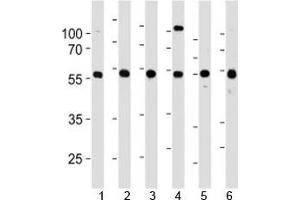 YY1 antibody western blot analysis in 1) 293, 2) HL-60, 3) SiHa, 4) K562, 5) THP-1 and 6) U266 lysate.