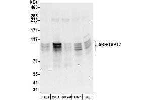 Western Blotting (WB) image for anti-rho GTPase Activating Protein 12 (ARHGAP12) (AA 100-150) antibody (ABIN7453034)