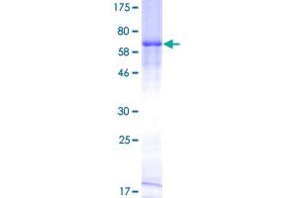 HAVCR1 Protein (AA 1-364) (GST tag)