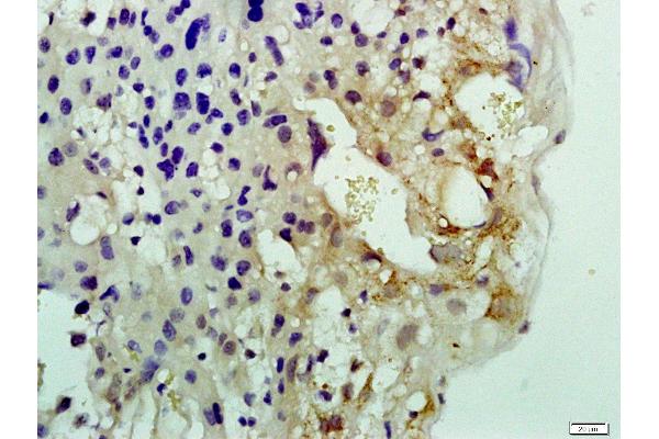 Nucleolar Protein 1 (NOL1) antibody