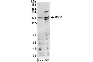 Western Blotting (WB) image for anti-MutS Homolog 6 (E. Coli) (MSH6) (C-Term) antibody (ABIN7454511)
