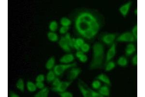 Detection of CXADR in Human Hela Cell using Polyclonal Antibody to Coxsackie Virus And Adenovirus Receptor (CXADR) (Coxsackie Adenovirus Receptor antibody  (AA 20-229))