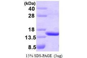 Figure annotation denotes ug of protein loaded and % gel used. (TBCA Protein (AA 1-108))