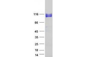 Western Blotting (WB) image for Integrin beta 5 (ITGB5) protein (Myc-DYKDDDDK Tag) (ABIN2723530)
