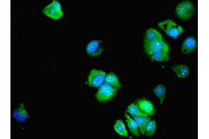 Immunofluorescent analysis of MCF-7 cells using ABIN7145831 at dilution of 1:100 and Alexa Fluor 488-congugated AffiniPure Goat Anti-Rabbit IgG(H+L) (BTBD2 antibody  (AA 321-525))
