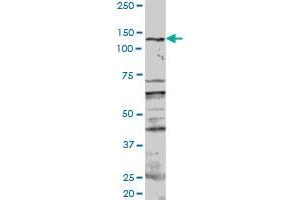 PKN1 MaxPab rabbit polyclonal antibody. (PKN1 antibody  (AA 1-942))