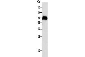 Gel: 10 % SDS-PAGE, Lysate: 40 μg, Lane: Human thigh malignant fibrous histiocytoma tissue, Primary antibody: ABIN7131272(SYT5 Antibody) at dilution 1/100, Secondary antibody: Goat anti rabbit IgG at 1/8000 dilution, Exposure time: 8 hours (Synaptotagmin V antibody)