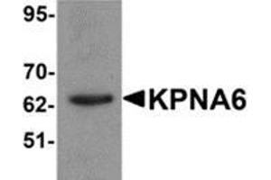 Western blot analysis of KPNA6 in 293 cell lysate with KPNA6 antibody at 1 μg/ml.