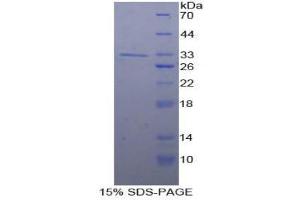 SDS-PAGE (SDS) image for SMAD, Mothers Against DPP Homolog 5 (SMAD5) (AA 210-464) protein (His tag) (ABIN1879286)