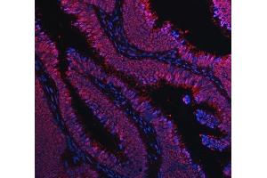 IF analysis of TIP49A/RUVBL1 using anti-TIP49A/RUVBL1 antibody (ABIN7599928).
