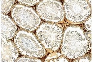 ABIN6265760 and ABIN6278538 at 1/100 staining Rat testis tissue by IHC-P.