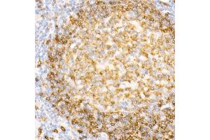 Immunohistochemistry of paraffin-embedded Human tonsil using CD79a antibody (ABIN7265805) at dilution of 1:100 (40x lens). (CD79a antibody)