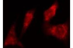 ABIN6277985 staining  Hela cells by IF/ICC. (CDC6 antibody)