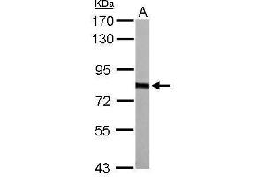 WB Image HADHA antibody detects HADHA protein by Western blot analysis. (HADHA antibody  (C-Term))