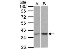 Western Blotting (WB) image for anti-Protein Phosphatase 2, Catalytic Subunit, alpha Isozyme (PPP2CA) (C-Term) antibody (ABIN2856333)
