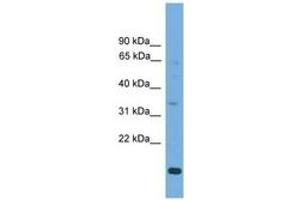 Image no. 1 for anti-Solute Carrier Family 25, Member 44 (SLC25A44) (C-Term) antibody (ABIN6745599) (SLC25A44 antibody  (C-Term))