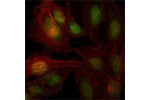 Immunofluorescence analysis of Hela cells using ZBTB7B antibody (green). (ZBTB7B antibody)