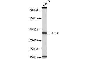 Western blot analysis of extracts of various cell lines, using RPP38 antibody (ABIN7269983) at 1:1000 dilution. (RPP38 antibody  (AA 20-110))