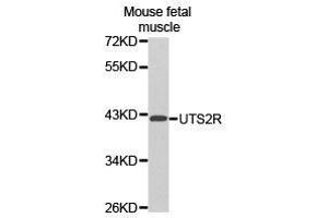 Western Blotting (WB) image for anti-Urotensin 2 Receptor (UTS2R) antibody (ABIN1875304) (UTS2R antibody)