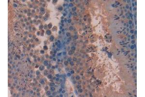 DAB staining on IHC-P; Samples: Mouse Testis Tissue (Pituitary Adenylate Cyclase Activating Peptide (AA 1-175) antibody)